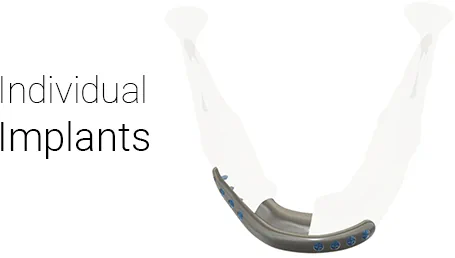 Customy-made implants
