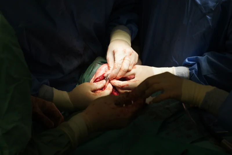 The implant fixation